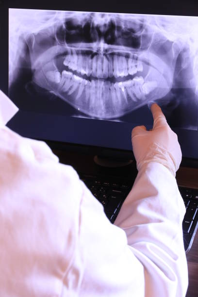 Best Emergency Root Canal Treatment in Second Mesa, AZ