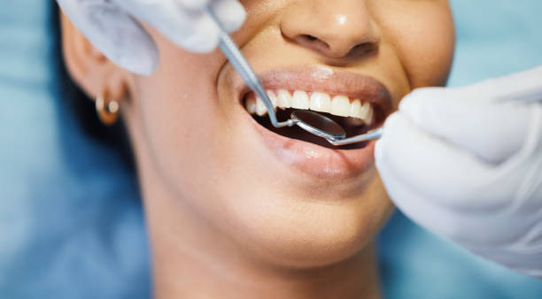 Best Urgent Care for Lost Fillings or Crowns in Second Mesa, AZ