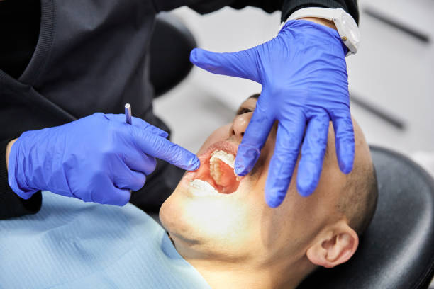 Best Emergency Treatment for Dental Infections or Abscesses in Second Mesa, AZ